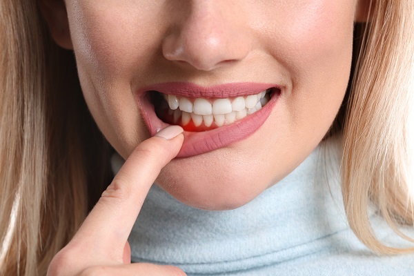 Could Gum Disease Be A Sign Of Another Condition?