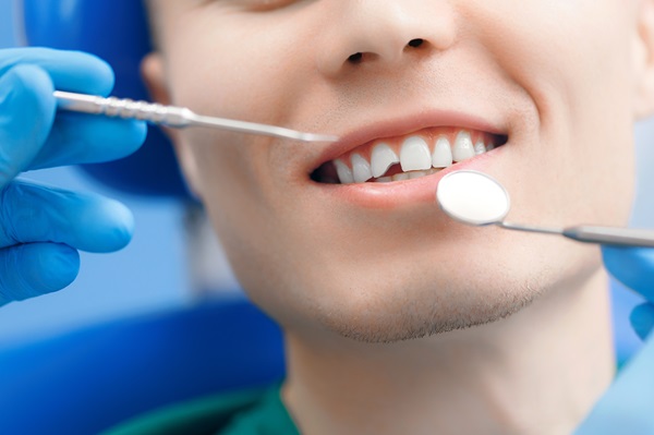 What To Do When You Have A Broken Tooth: Expert Dental Advice