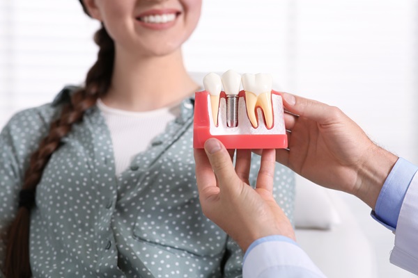 Dental Implants And Bridges To Replace Multiple Missing Teeth