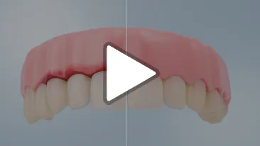 Gum Disease