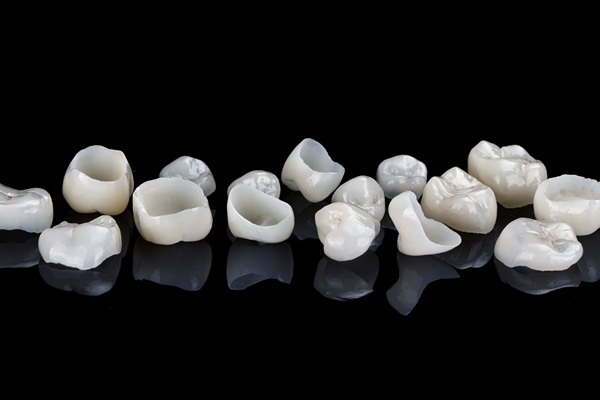 What Materials Are Used To Make An Implant Crown?