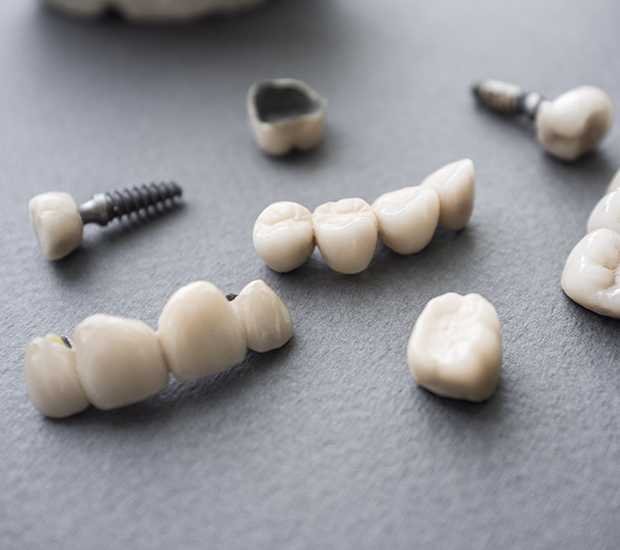 Mountain View The Difference Between Dental Implants and Mini Dental Implants