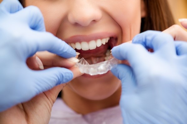 Invisalign Clear Aligners: A Teeth Straightening Procedure For Adults