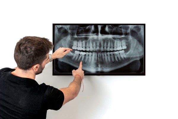 Why You Should Schedule An Oral Cancer Screening With Your Dentist
