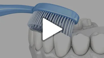 Oral Hygiene