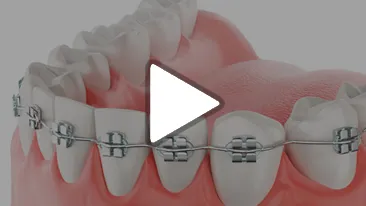 Orthodontics