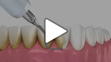 Primary Tooth Eruption