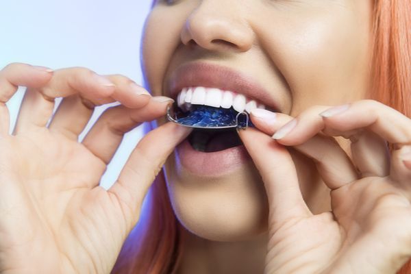 Popular Teeth Straightening Treatments From Your Dentist