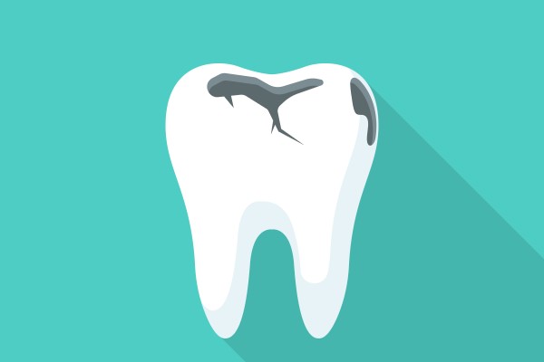 Can The Damage From Tooth Decay Be Repaired?