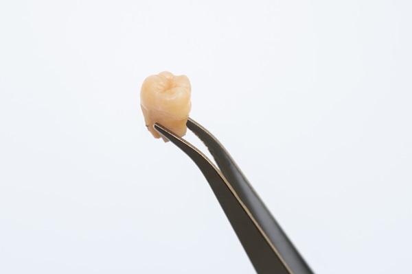 When Is Wisdom Tooth Extraction Necessary?